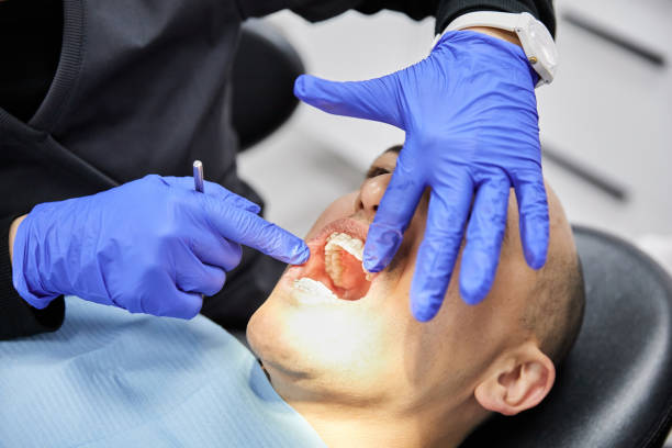 Best Emergency Wisdom Teeth Removal in Amarillo, TX
